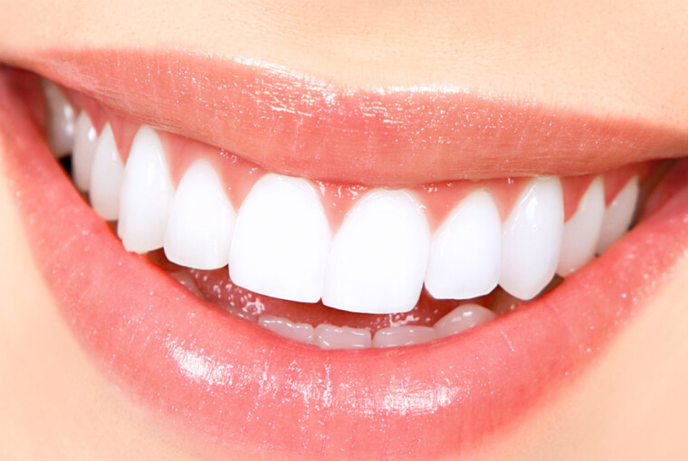 Celebrities Teeth Whitening Secrets Revealed - White, teeth, dentist
