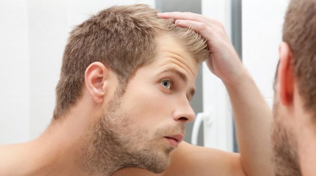 2019 Guide to Hair Loss Prevention - prevention, man, loss, Hair