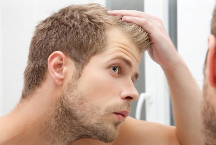 2019 Guide to Hair Loss Prevention - prevention, man, loss, Hair