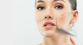 THE SKIN BEFORE AND AFTER ACNE REMOVAL BY THE EXPERTS