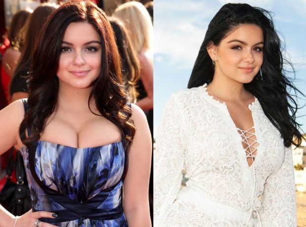Ariel Winter – Before and After