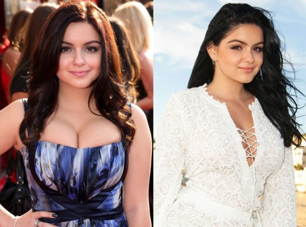 Ariel Winter – Before and After Ariel Winter – Before and After