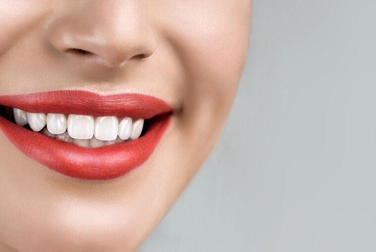 Veneers Turkey Veneers Turkey - veneers, Turkey, laminate, health, dental