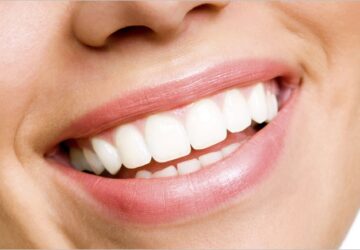 How You Can Improve Your Smile in A Week - smile, improve, dental, crown, appointment