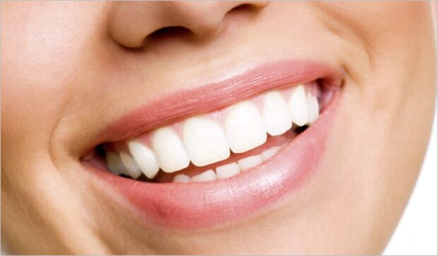 How You Can Improve Your Smile in A Week - smile, improve, dental, crown, appointment