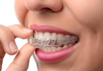 Invisalign Benefits & The Process - teeth, orthodontist, invisalign, dental