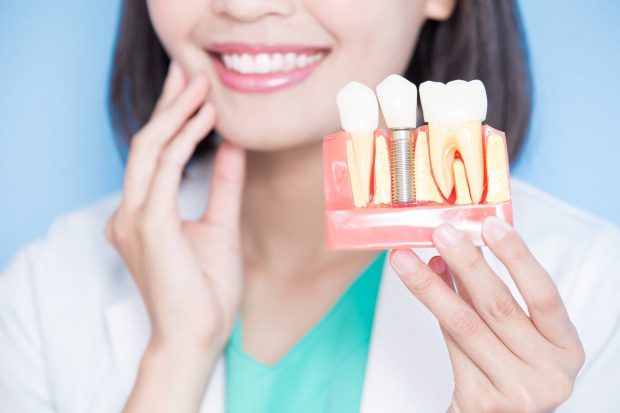 When Should You Opt for Dental Implants? - health, dental, beauty