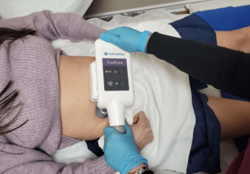 Does CoolSculpting Actually Work? - coolsculpting, beauty