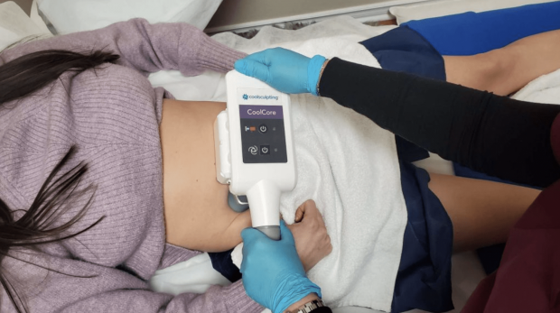 Does CoolSculpting Actually Work? - coolsculpting, beauty