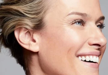 How to Get Rid of Crow's Feet? - moisturize, face, exercise, dermal fillers, crow's feet, botox