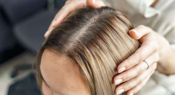 Understanding Hair Loss and Treatment Options