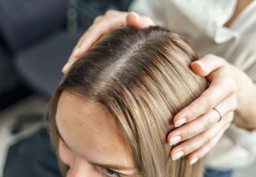 Understanding Hair Loss and Treatment Options - treatment, transplants, steroid injections, medication, hair loss, diet