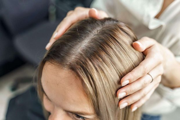 Understanding Hair Loss and Treatment Options - treatment, transplants, steroid injections, medication, hair loss, diet