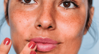 Thinking About a Lip Flip? Here’s Why It Might Just Be Your Next Beauty Move