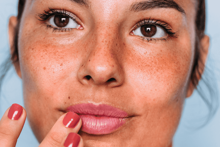 Thinking About a Lip Flip? Here's Why It Might Just Be Your Next Beauty Move - Lip flip, lip fillers, Cosmetic procedure, botox, Beauty enhancement